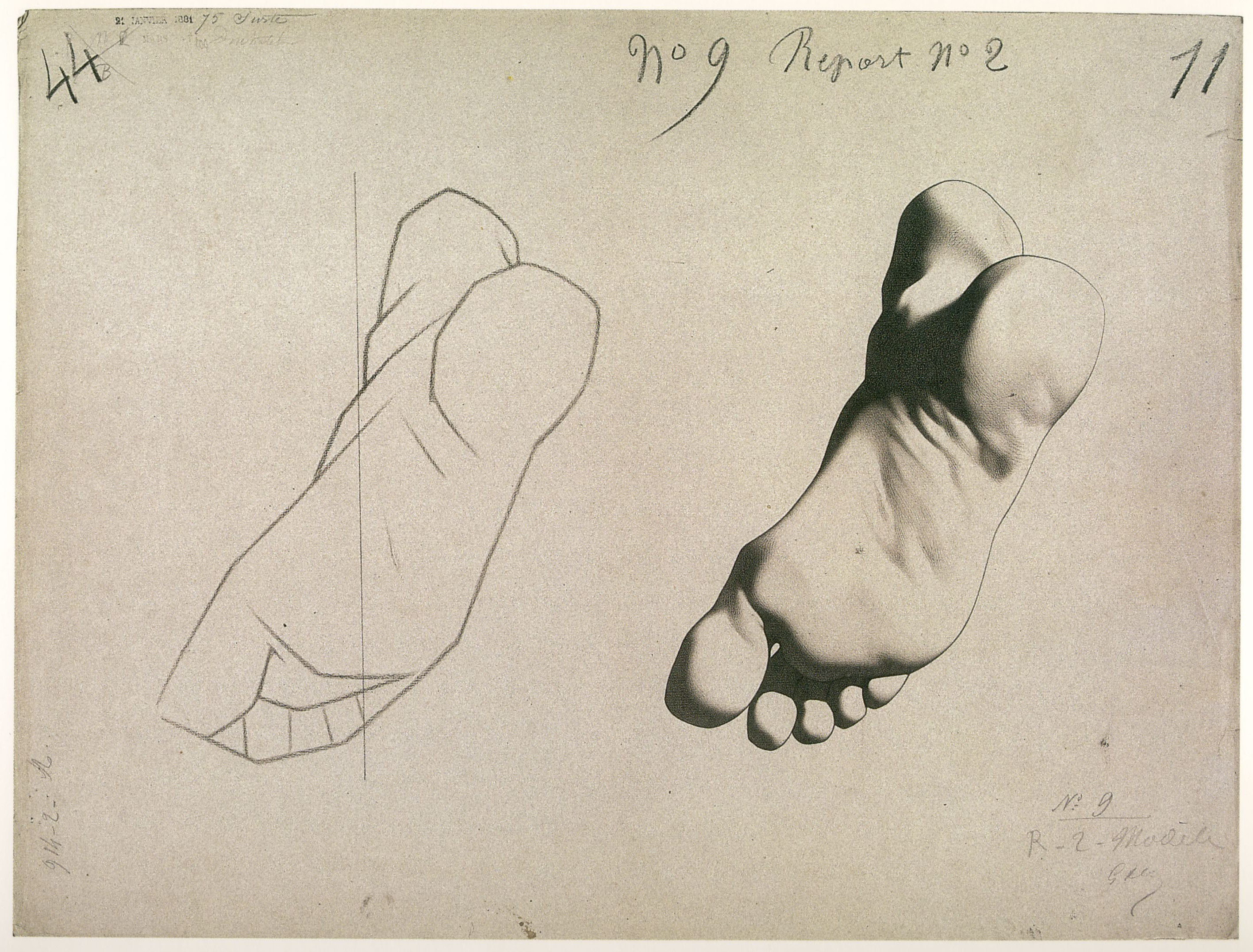 Plate I,9 - Sole of the foot