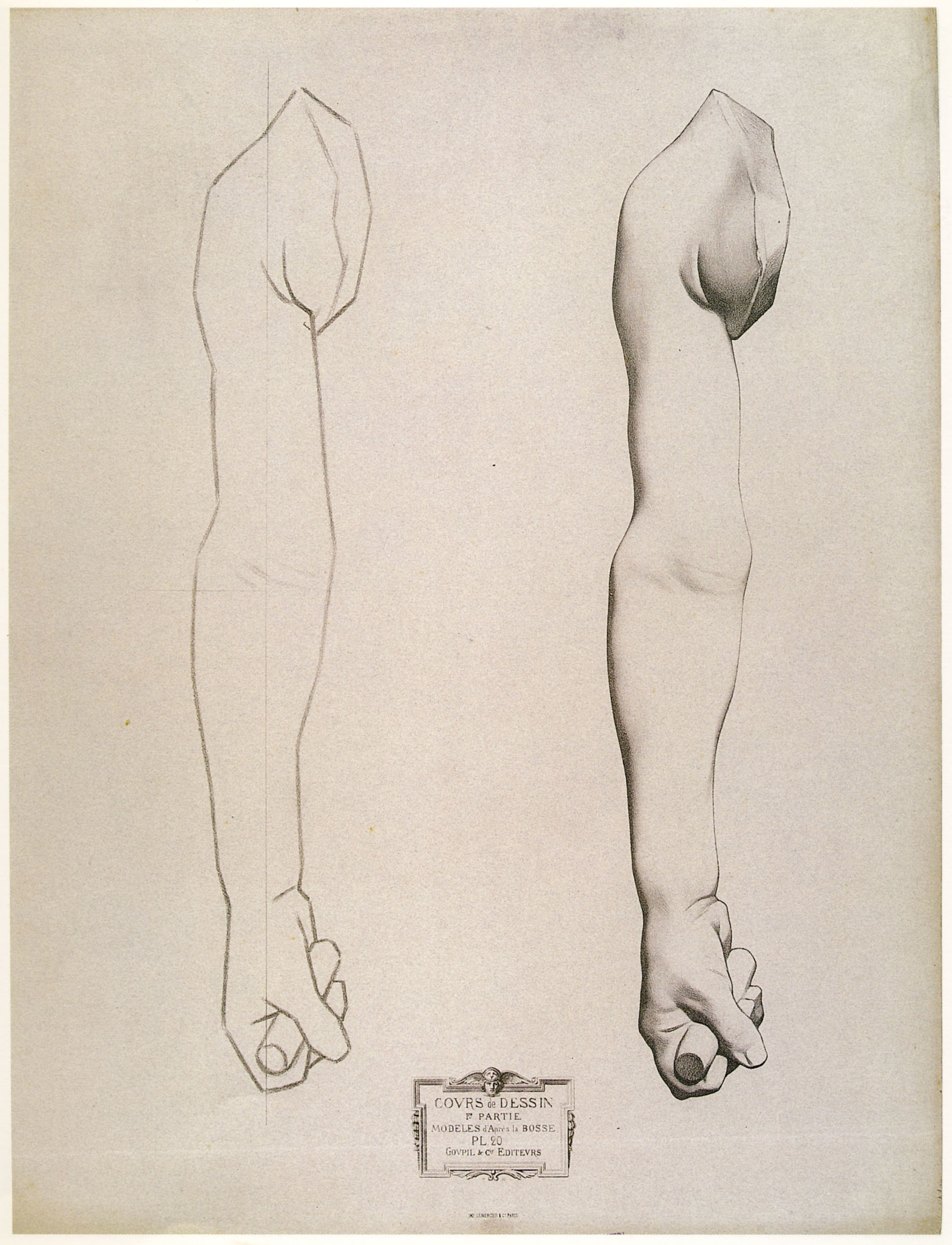 Plate I,20 - Child's arm, interior view