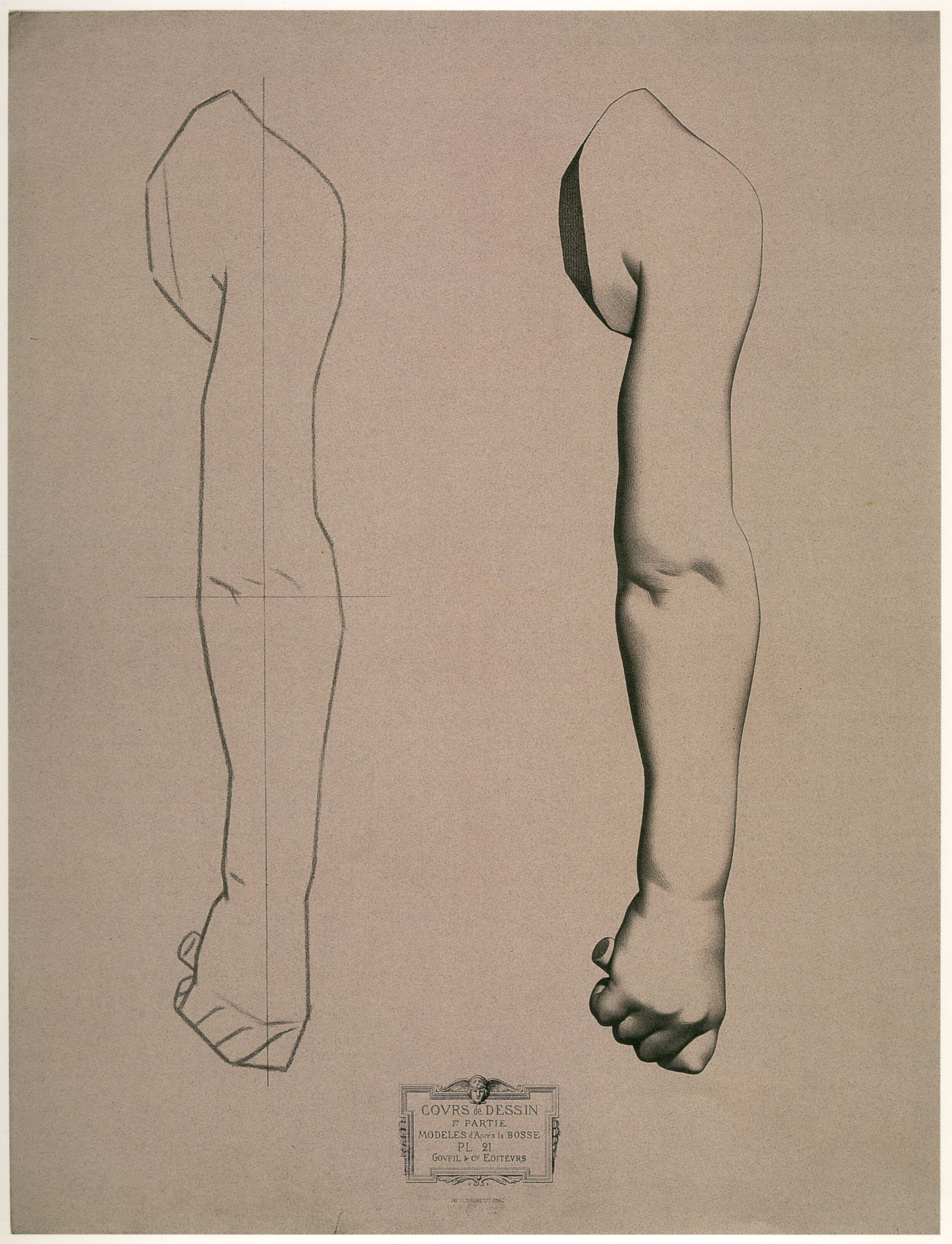 Plate I,21 - Child's arm, exterior view