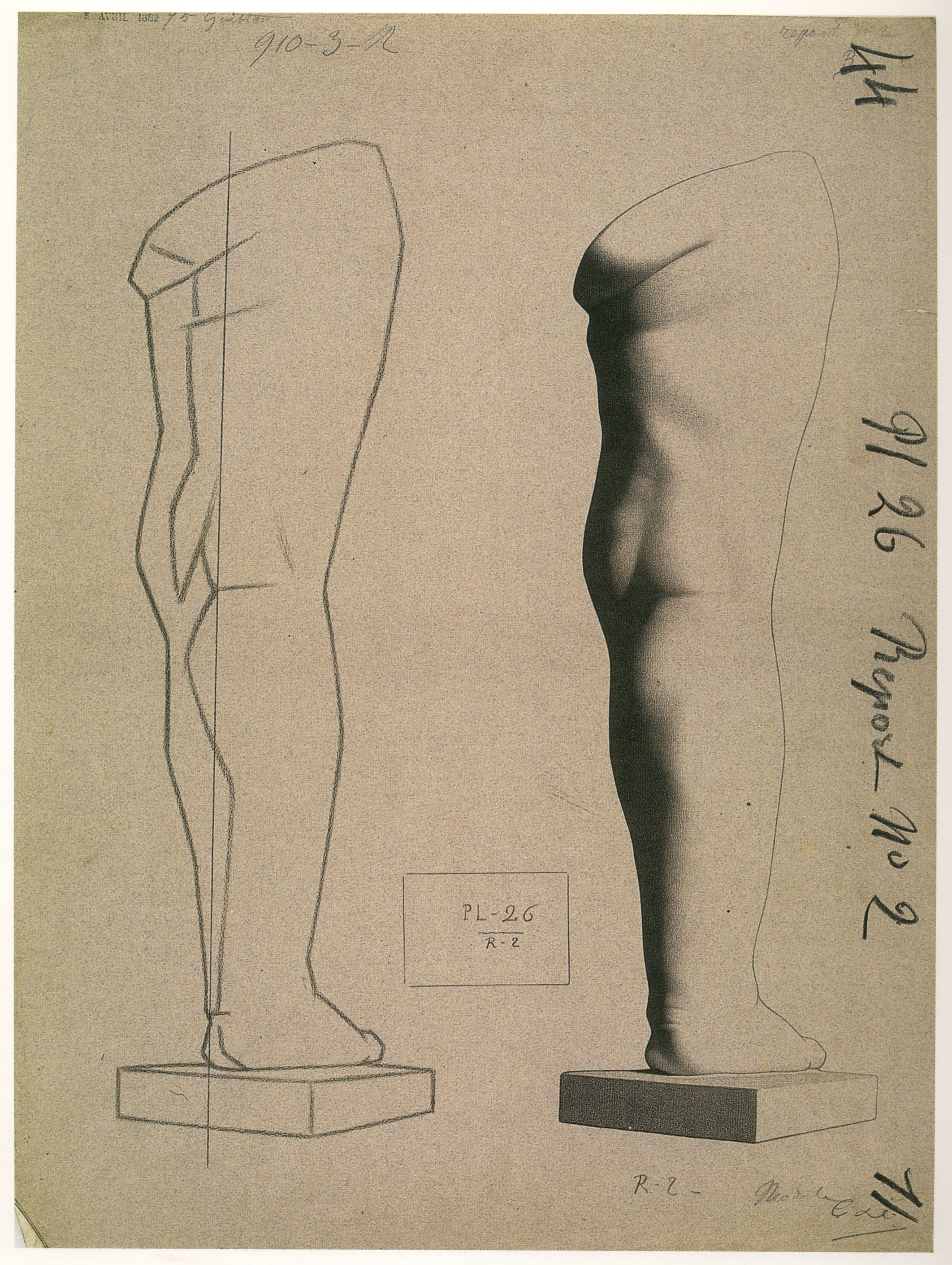 Plate I,26 - Child’s leg, rear view